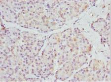 SFRP-3 / FRZB Antibody - Immunohistochemistry of paraffin-embedded Human pancreatic tissue at dilution 1:100