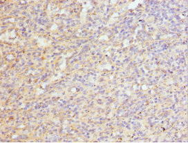 SFRP-3 / FRZB Antibody - Immunohistochemistry of paraffin-embedded human spleen tissue at dilution 1:100