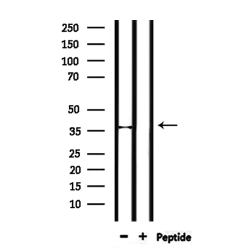 SFRP-3 / FRZB Antibody - Western blot analysis of extracts of mouse liver tissue using SFRP3 antibody.