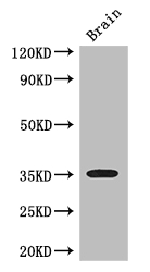 SFRP1 Antibody - Positive WB detected in:Mouse brain tissue;All lanes: SFRP1 antibody at 3ug/ml;Secondary;Goat polyclonal to rabbit IgG at 1/50000 dilution;Predicted band size: 36 kDa;Observed band size: 36 kDa;