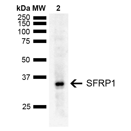 SFRP1 Antibody - Western blot analysis of Rat Liver showing detection of ~35 kDa SFRP1 protein using Rabbit Anti-SFRP1 Polyclonal Antibody. Lane 1: Molecular Weight Ladder (MW). Lane 2: Rat Liver. Load: 15 µg. Block: 5% Skim Milk in 1X TBST. Primary Antibody: Rabbit Anti-SFRP1 Polyclonal Antibody  at 1:1000 for 2 hours at RT. Secondary Antibody: Goat Anti-Rabbit IgG: HRP at 1:5000 for 1 hour at RT. Color Development: ECL solution for 5 min at RT. Predicted/Observed Size: ~35 kDa.