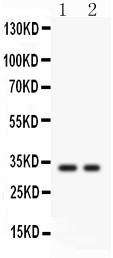 SFRP2 Antibody - SFRP2 antibody Western blot. All lanes: Anti SFRP2 at 0.5 ug/ml. Lane 1: COLO320 Whole Cell Lysate at 40 ug. Lane 2: SW620 Whole Cell Lysate at 40 ug. Predicted band size: 33 kD. Observed band size: 33 kD.