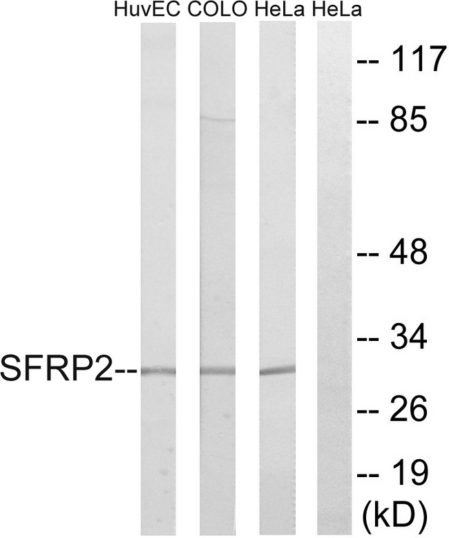 SFRP2 Antibody - Western blot analysis of lysates from HeLa, COLO, and HUVEC cells, using SFRP2 Antibody. The lane on the right is blocked with the synthesized peptide.