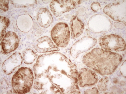 SFRP2 Antibody - Immunohistochemical staining of paraffin-embedded Human Kidney tissue within the normal limits using anti-SFRP2 mouse monoclonal antibody. (Heat-induced epitope retrieval by 1 mM EDTA in 10mM Tris, pH8.5, 120C for 3min,