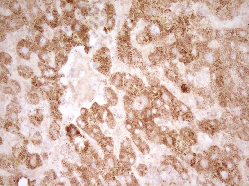 SFRP2 Antibody - Immunohistochemical staining of paraffin-embedded Human liver tissue within the normal limits using anti-SFRP2 mouse monoclonal antibody. (Heat-induced epitope retrieval by 1 mM EDTA in 10mM Tris, pH8.5, 120C for 3min,