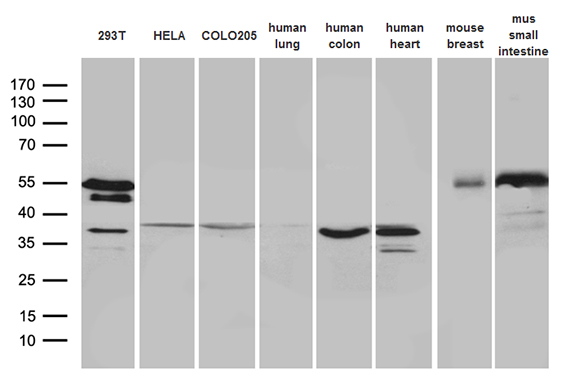SFRP2 Antibody - Western blot analysis of extracts. (35ug) from 3 different cell lines and 5 different tissue lysates by using anti-SFRP2 monoclonal antibody. (1:500)