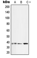 SFRP2 Antibody - Western blot analysis of SFRP2 expression in SKNSH (A); Jurkat (B); A431 (C) whole cell lysates.