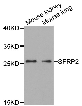 SFRP2 Antibody - Western blot analysis of extracts of various cells.