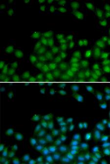 SFRP2 Antibody - Immunofluorescence analysis of HeLa cells.