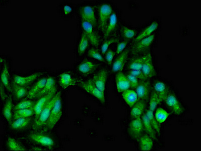 SFRP2 Antibody - Immunofluorescent analysis of Hela cells diluted at 1:100 and Alexa Fluor 488-congugated AffiniPure Goat Anti-Rabbit IgG(H+L)
