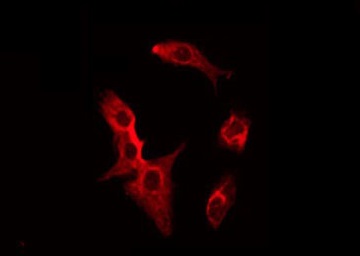 SFRP2 Antibody - Staining HeLa cells by IF/ICC. The samples were fixed with PFA and permeabilized in 0.1% Triton X-100, then blocked in 10% serum for 45 min at 25°C. The primary antibody was diluted at 1:200 and incubated with the sample for 1 hour at 37°C. An Alexa Fluor 594 conjugated goat anti-rabbit IgG (H+L) Ab, diluted at 1/600, was used as the secondary antibody.