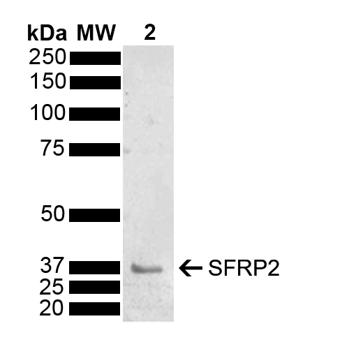 SFRP2 Antibody - Western blot analysis of Mouse Brain showing detection of 33.5 kDa SFRP2 protein using Rabbit Anti-SFRP2 Polyclonal Antibody. Lane 1: Molecular Weight Ladder (MW). Lane 2: Mouse Brain. Load: 15 µg. Block: 5% Skim Milk powder in TBST. Primary Antibody: Rabbit Anti-SFRP2 Polyclonal Antibody  at 1:1000 for 2 hours at RT with shaking. Secondary Antibody: Goat Anti-Rabbit IgG: HRP at 1:5000 for 1 hour at RT. Color Development: ECL solution for 5 min at RT. Predicted/Observed Size: 33.5 kDa. Other Band(s): 37 kDa.