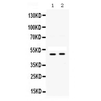 SFRP4 Antibody - Western blot analysis of SFRP4 expression in A549 whole cell lysates (lane 1) and SW620 whole cell lysates (lane 2). SFRP4 at 49 kD was detected using rabbit anti- SFRP4 Antigen Affinity purified polyclonal antibody at 0.5 ug/mL. The blot was developed using chemiluminescence (ECL) method.
