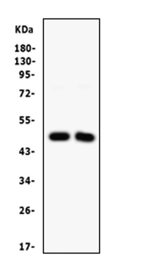 SFRP4 Antibody - Western blot analysis of SFRP4 expression in A549 whole cell lysates (lane 1) and SW620 whole cell lysates (lane 2). SFRP4 at 49KD was detected using rabbit anti-SFRP4 Antigen Affinity purified polyclonal antibody at0.5 ug/ml. The blot was developed using chemiluminescence (ECL) method.