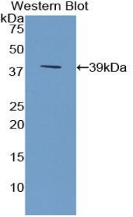 SFRP4 Antibody - Western blot of SFRP4 antibody.