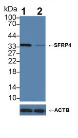 SFRP4 Antibody - Knockout Varification: Lane 1: Wild-type Hela cell lysate; Lane 2: SFRP4 knockout Hela cell lysate; Predicted MW: 40kDa Observed MW: 35kDa Primary Ab: 2µg/ml Mouse Anti-Human SFRP4 Antibody Second Ab: 0.2µg/mL HRP-Linked Caprine Anti-Mouse IgG Polyclonal Antibody