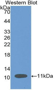 SFRP4 Antibody - Western blot of recombinant SFRP4.