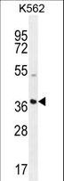 SFRP4 Antibody - SFRP4 Antibody western blot of K562 cell line lysates (35 ug/lane). The SFRP4 antibody detected the SFRP4 protein (arrow).