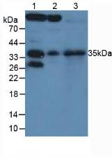 SFRP5 Antibody - Western Blot; Sample: Lane1: Rat Pancreas Tissue; Lane2: Rat Eye Tissue; Lane3: Human WERI-RB-1 Cells.