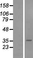 SFRP5 Protein - Western validation with an anti-DDK antibody * L: Control HEK293 lysate R: Over-expression lysate