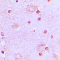 SFRS7 / 9G8 Antibody - Immunohistochemical analysis of SRSF7 staining in human brain formalin fixed paraffin embedded tissue section. The section was pre-treated using heat mediated antigen retrieval with sodium citrate buffer (pH 6.0). The section was then incubated with the antibody at room temperature and detected using an HRP conjugated compact polymer system. DAB was used as the chromogen. The section was then counterstained with hematoxylin and mounted with DPX.