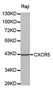 SFRS7 / 9G8 Antibody - Western blot analysis of extracts of Raji cell lines.