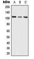 SFSWAP / SWAP Antibody - Western blot analysis of SWAP expression in HeLa (A); SP2/0 (B); PC12 (C) whole cell lysates.
