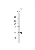 SFT2D2 Antibody - Anti-SFT2D2 Antibody at 1:1000 dilution + PC-12 whole cell lysates Lysates/proteins at 20 ug per lane. Secondary Goat Anti-Rabbit IgG, (H+L),Peroxidase conjugated at 1/10000 dilution Predicted band size : 18 kDa Blocking/Dilution buffer: 5% NFDM/TBST.