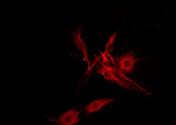 SFT2D2 Antibody - Staining LOVO cells by IF/ICC. The samples were fixed with PFA and permeabilized in 0.1% Triton X-100, then blocked in 10% serum for 45 min at 25°C. The primary antibody was diluted at 1:200 and incubated with the sample for 1 hour at 37°C. An Alexa Fluor 594 conjugated goat anti-rabbit IgG (H+L) Ab, diluted at 1/600, was used as the secondary antibody.
