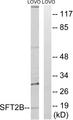SFT2D2 Antibody - Western blot analysis of extracts from LOVO cells, using SFT2B antibody.