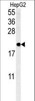 SFT2D3 Antibody - SFT2D3 Antibody western blot of HepG2 cell line lysates (35 ug/lane). The SFT2D3 antibody detected the SFT2D3 protein (arrow).