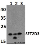 SFT2D3 Antibody - Western blot of SFT2D3 polyclonal antibody at 1:500 dilution. Lane 1: PC12 whole cell lysate (40 ug). Lane 2: Jurkat whole cell lysate(40 ug). Lane 3: NIH-3T3 whole cell lysate (40 ug).