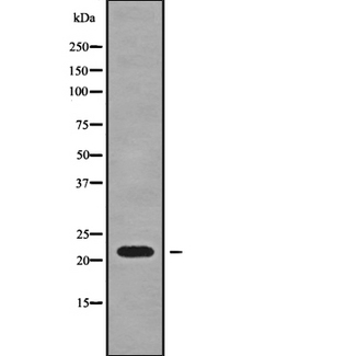 SFT2D3 Antibody - Western blot analysis SFT2D3 using HT29 whole cells lysates