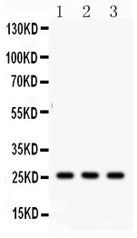 SFTPA1 + SFTPA2 Antibody - SFTP A1/2 antibody Western blot. All lanes: Anti SFTP at 0.5 ug/ml. Lane 1: Rat Lung Tissue Lysate at 50 ug. Lane 2: Mouse Lung Tissue Lysate at 50 ug. Lane 3: A549 Whole Cell Lysate at 40 ug. Predicted band size: 26 kD. Observed band size: 26 kD.