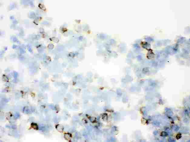 SFTPA1 + SFTPA2 Antibody - anti-SFTP A1/2 Picoband antibody IHC(F)IHC(F): Rat Lung Tissue