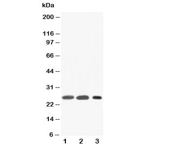 SFTPA1 / Surfactant Protein A Antibody - Western blot testing of SFTPA1 antibody and Lane 1: rat lung; 2: rat lung; 3: human Raji