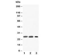 SFTPA1 / Surfactant Protein A Antibody - Western blot testing of SFTPA1 antibody and Lane 1: rat lung; 2: rat lung; 3: human Raji