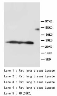 SFTPA1 / Surfactant Protein A Antibody -  This image was taken for the unconjugated form of this product. Other forms have not been tested.