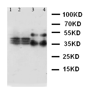 SFTPA1 / Surfactant Protein A Antibody - WB of SFTPA1 / Surfactant Protein A antibody. Lane 1: Mouse Lung Tissue Lysate. Lane 2: Mouse Lung Tissue Lysate. Lane 3: Rat Lung Tissue Lysate. Lane 4: Rat Lung Tissue Lysate.