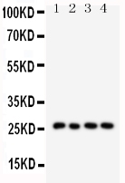 SFTPA1 / Surfactant Protein A Antibody - Western blot analysis of SFTPA1 using anti-SFTPA1 antibody. Electrophoresis was performed on a 5-20% SDS-PAGE gel at 70V (Stacking gel) / 90V (Resolving gel) for 2-3 hours. The sample well of each lane was loaded with 50ug of sample under reducing conditions. Lane 1: mouse lung tissue lysates, Lane 2: mouse lung tissue lysates, Lane 3: rat lung tissue lysates, Lane 4: rat lung tissue lysates. After Electrophoresis, proteins were transferred to a Nitrocellulose membrane at 150mA for 50-90 minutes. Blocked the membrane with 5% Non-fat Milk/ TBS for 1.5 hour at RT. The membrane was incubated with rabbit anti-SFTPA1 antigen affinity purified polyclonal antibody at 0.5 µg/mL overnight at 4°C, then washed with TBS-0.1% Tween 3 times with 5 minutes each and probed with a goat anti-rabbit IgG-HRP secondary antibody at a dilution of 1:10000 for 1.5 hour at RT. The signal is developed using an Enhanced Chemiluminescent detection (ECL) kit with Tanon 5200 system. A specific band was detected for SFTPA1 at approximately 26KD. The expected band size for SFTPA1 is at 26KD.