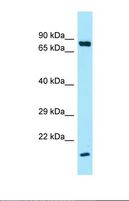 SFTPA1 / Surfactant Protein A Antibody - Western blot of Human HCT15. SFTPA1 antibody dilution 1.0 ug/ml.  This image was taken for the unconjugated form of this product. Other forms have not been tested.