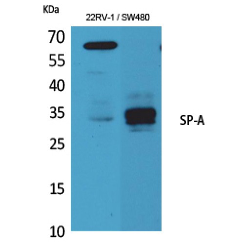SFTPA1 / Surfactant Protein A Antibody - Western blot of SP-A antibody