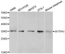SFTPA1 / Surfactant Protein A Antibody - Western blot analysis of extracts of various cell lines, using SFTPA1antibody.
