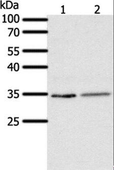 SFTPA1 / Surfactant Protein A Antibody - Western blot analysis of Human fetal lung tissue and A549 cell, using SFTPA1 Polyclonal Antibody at dilution of 1:300.