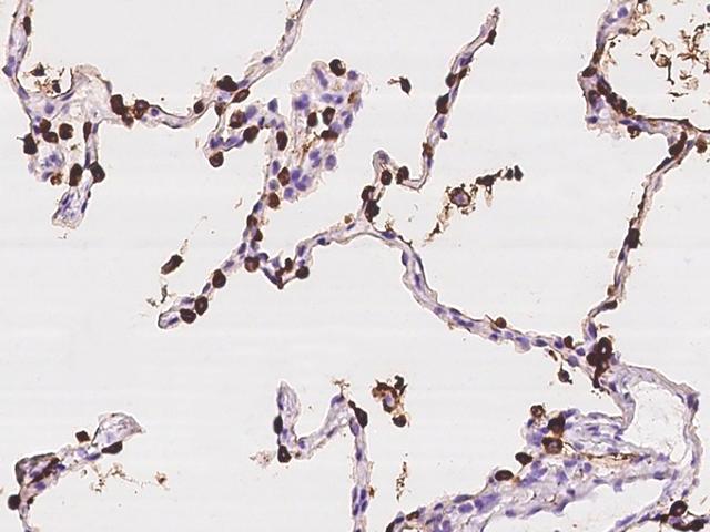 SFTPA1 / Surfactant Protein A Antibody - Immunochemical staining of human SFTPA1 in human lung with rabbit polyclonal antibody at 1:1000 dilution, formalin-fixed paraffin embedded sections.
