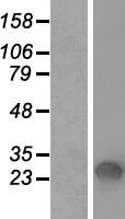 SFTPA1 / Surfactant Protein A Protein - Western validation with an anti-DDK antibody * L: Control HEK293 lysate R: Over-expression lysate