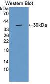 SFTPA2 / Surfactant Protein A2 Antibody - Western blot of SFTPA2 / Surfactant Protein A2 antibody.