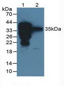 SFTPA2 / Surfactant Protein A2 Antibody - Western Blot; Sample: Lane1: Rat Lung Tissue; Lane2: Rat Heart Tissue.