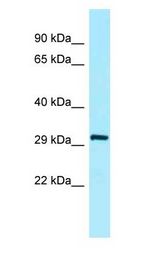 SFTPA2 / Surfactant Protein A2 Antibody - SFTPA2 antibody Western Blot of Fetal Heart.  This image was taken for the unconjugated form of this product. Other forms have not been tested.