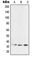 SFTPA2 / Surfactant Protein A2 Antibody - Western blot analysis of SFTPA2 expression in A549 (A); HCT15 (B); mouse lung (C) whole cell lysates.